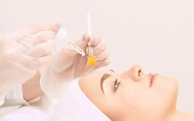 Benefits of a Chemical Peel: Discovering Healthier Skin